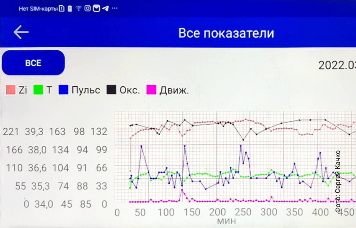 Умный браслет челябинских ученых измерит реакции нервной системы | Новости  науки